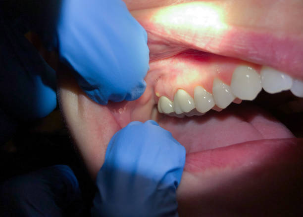 Best Knocked-Out Tooth Emergency  in Canyon Day, AZ