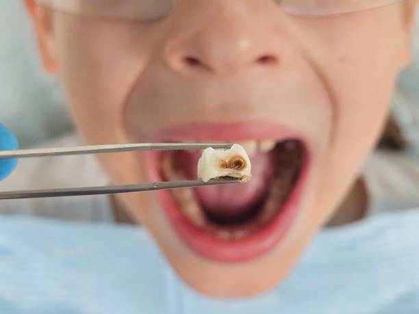 Best Broken Tooth Emergency  in Canyon Day, AZ
